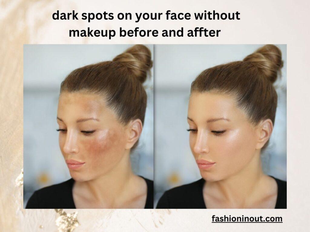 dark spots on your face without makeup before and affter