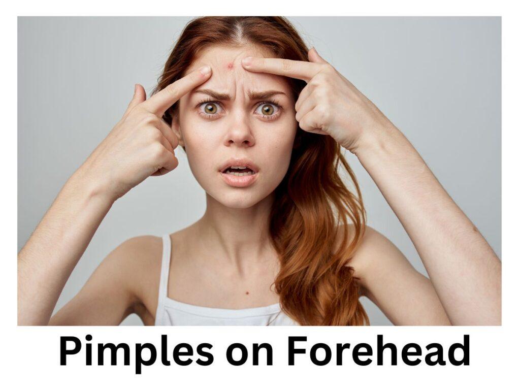 How to Get Rid of Pimples on Forehead Overnight?