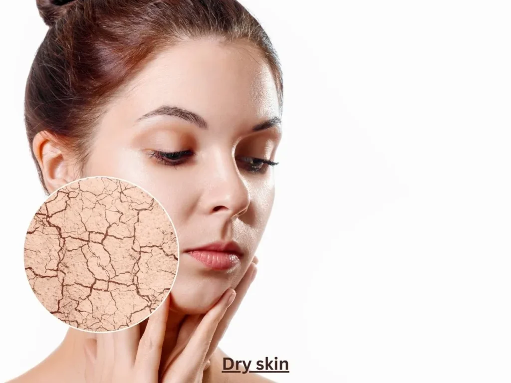 dry skin image