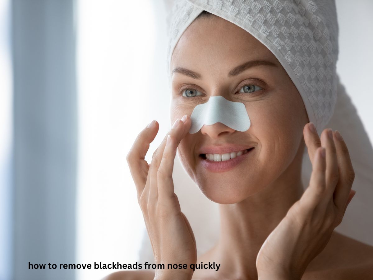 how to remove blackheads from nose quickly